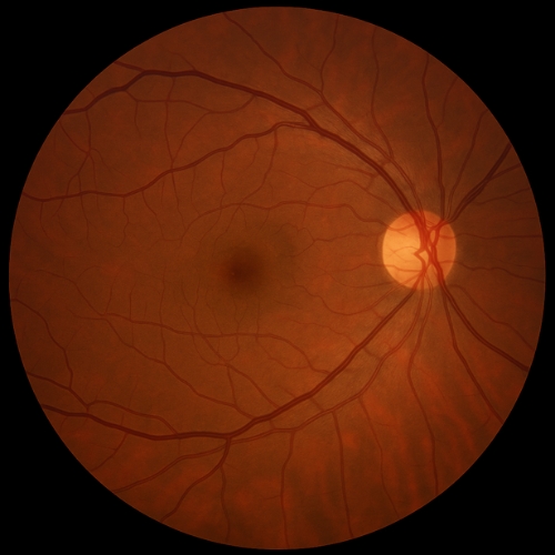 Fundus foto